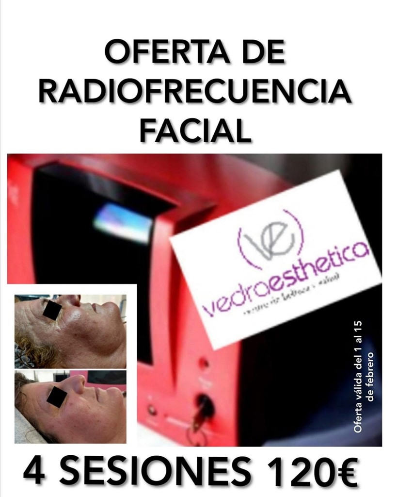 OFERTA EN RADIOFRECUENCIA FACIAL