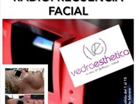 OFERTA EN RADIOFRECUENCIA FACIAL