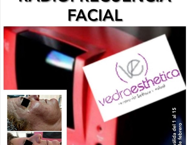 OFERTA EN RADIOFRECUENCIA FACIAL