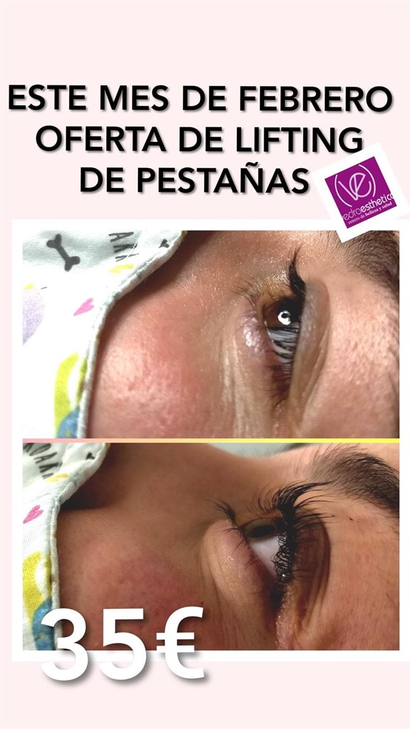 OFERTA LIFTING PESTAÑAS 